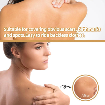 Skin concealing patch-waterproof cover for scars, tattoos, acne marks, birthmarks-natural looking, breathable, reusable