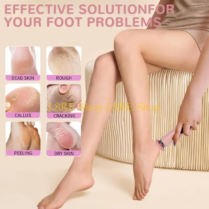 L8RE Portable Electric Foot Grinder 1000RPM Motor Fast Dead Skin Removal USB Charging Foot Callus Remover for Home Travel