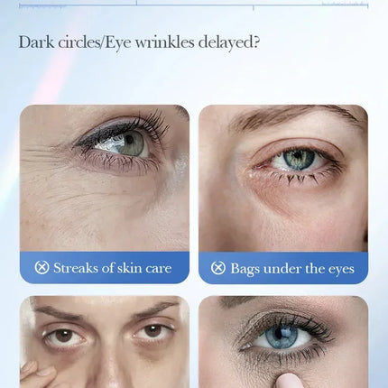 Caviar Eye Bag Removal Cream Hyaluronic Acid Anti-Wrinkle Firming Skin Fade Fine Lines Anti Dark Circle Puffiness Eye Care 20g