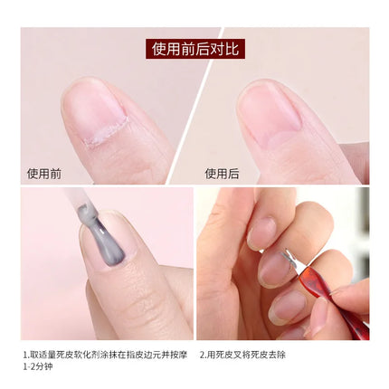 1Pcs Colors Dead Skin Remover Nail Art Fork Cuticle Remover Nipper Pusher Trimmer Stainless Steel Pedicure Nails Care Nail Tools