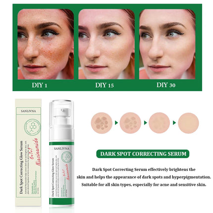 Dark spot correction essence effectively improves facial dullness, moisturizes and brightens skin tone, gentle essence 50ml