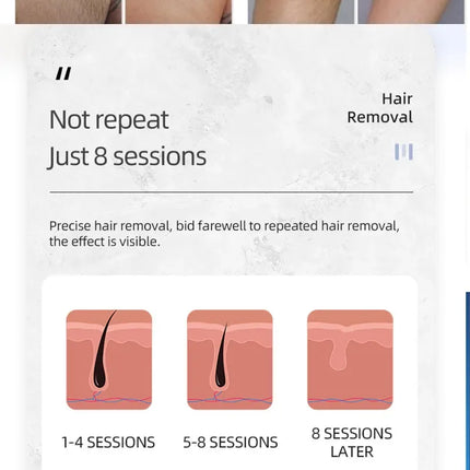 New system 808nm Diode Painless Permanent Hair Removal With Q Switch Nd Yag Laser Tatto Eyebrow Spot Removal Machine