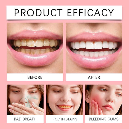 Probiotic Toothpaste Sp8 Mint Fresh Breath Remove Plaque Stains Prevent Periodontitis Teeth Keep Brighten Oral Care Toothpaste