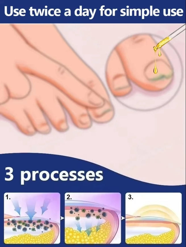 18 Quickly eliminate fungus and restore healthy nails