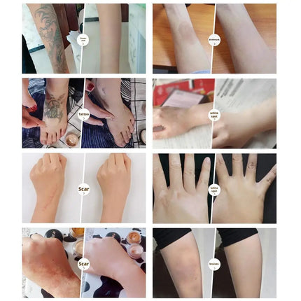 Two-color tattoo concealer waterproof and sweat-proof to cover birthmarks and scars long-lasting concealer foundation cream