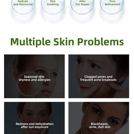Youbuy Aloe Gel Gel Moisturizing Facial Brightening Skin Care Product