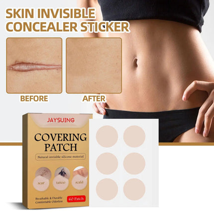 Skin concealing patch-waterproof cover for scars, tattoos, acne marks, birthmarks-natural looking, breathable, reusable