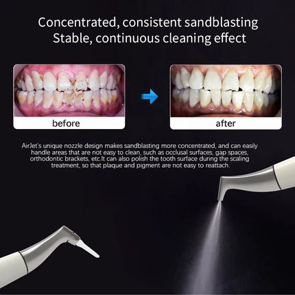 4-Jet Dental Air Polisher System - Kavo Quick Connect Prophy Unit with Adjustable 0-7PSI, Subgingival & Supragingival Cleaning