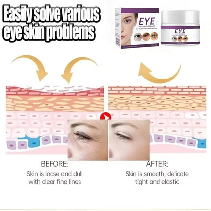 Remove Eye Bag Cream Anti Wrinkle Anti Dark Circle Eye Cream Repair Skin Damage Moisturizing Eye Bags Eyes Skin Care