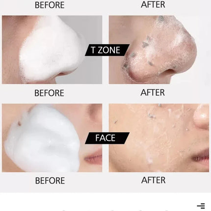 FAIR KING Exfoliating Mousse Improves Skin Texture Cleanses Makeup Dust Improves Enlarged Pores Absorbs Oil Cosmetics Wholesale