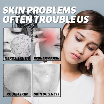 Facial Redness Repair Serum Improve Sensitive Skin Dryness Moisturizer Hydrating Sooth Lotion Removal Rosacea Korean Cosmetics