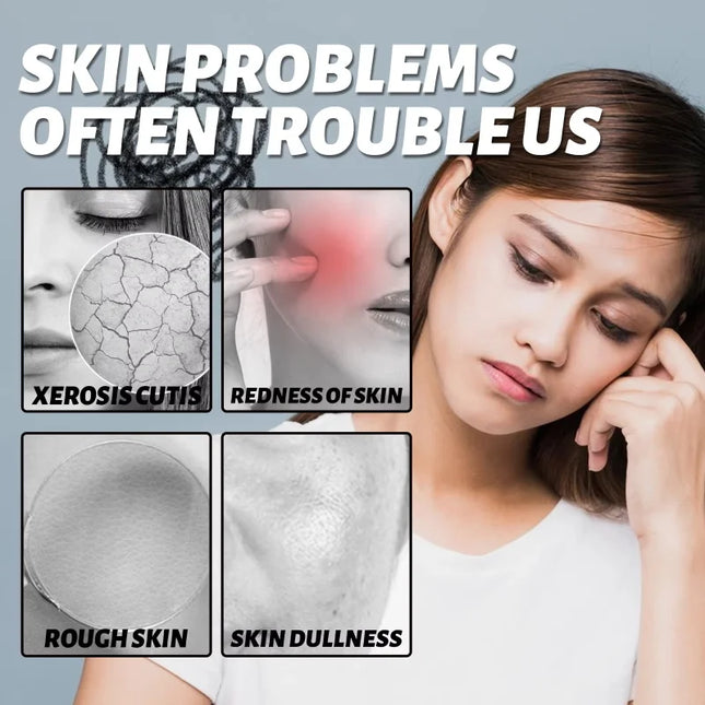 Facial Redness Repair Serum Improve Sensitive Skin Dryness Moisturizer Hydrating Sooth Lotion Removal Rosacea Korean Cosmetics