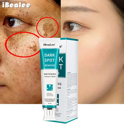 Effective Whitening Freckles Cream Remove Melasma Dark Spots Fade Melanin Pigmentation Moisturizing Brighten Skin Care Products