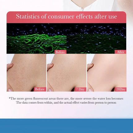 Body Whitening Cream Dark Skin Armpit Lightening Intimate Areas Underarm Bleaching Private Parts Whiten Cream Body Lotion Beauty