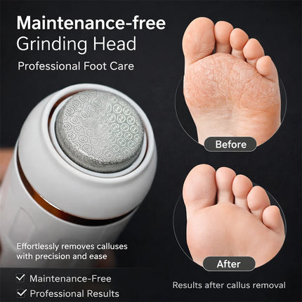 SoftAura Electric Foot Callus Remover Cordless Rechargeable 2 Gears Dry Skin Exfoliation Foot File for Home Pedicure Care