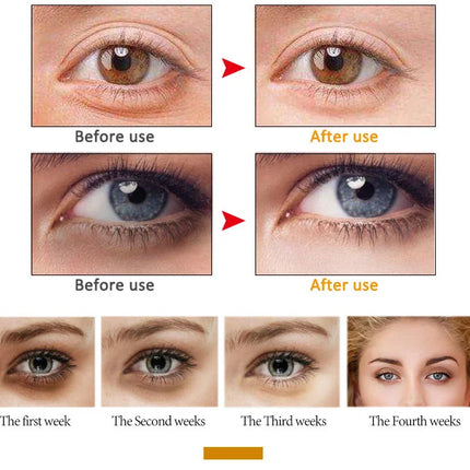 ARTISCARE Snail Face Cream + Peptide Eye Roller + Golden Eye Cream 3Pcs for Facial Moisturizing Serum Dark Circles Eye Care