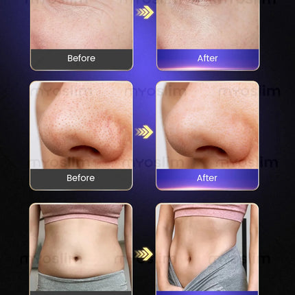Anti-Aging Facial Beauty Machine – Salon Professional Lifting Tightening Wrinkle & Fine Line Reduction Device