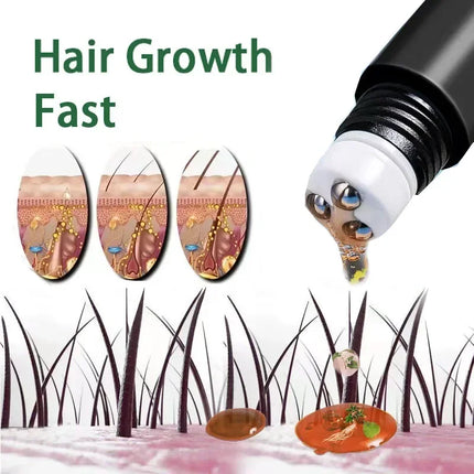 20ml Anti Hair Loss Effective Grow Thicker Hair Biotin Fast Hair Growth Oil Products Care Scalp Massage Treatments  For Men