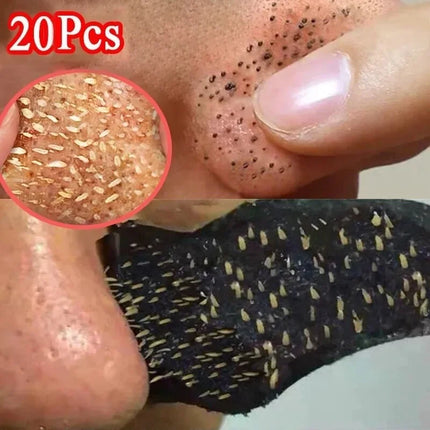 10/20/30Pcs Deep Cleansing Pore Nose Black Head Removal Stickers Peel Off Blackhead Remove Mask Nasal Strips Unisex Skin Care