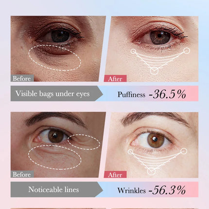 Instant Eye Bag Remove Cream Retinol Anti-Wrinkle Firming Skin Fade Fine Lines Anti Dark Circle Puffiness Brighten Eye SkinCare