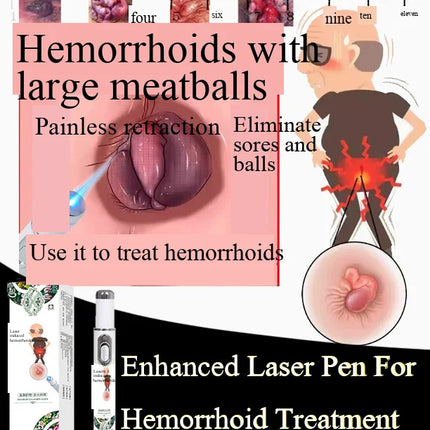 Enhanced Hemorrhoids Treatment Eliminates Internal External Hemorrhoids Lumps Fast Relief