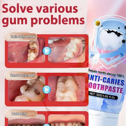 Cavity killer
