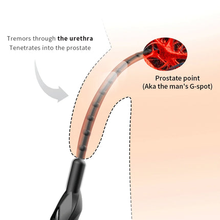 Electric Vibration Silicone Urethral Massager, Adult Male Penis Exercise Stimulation, Bead/Smooth Type