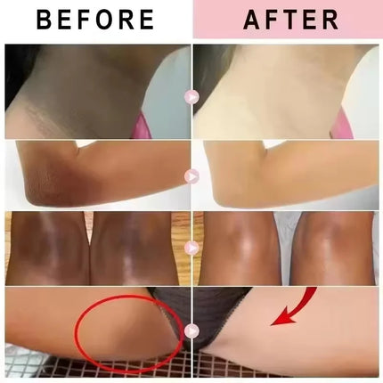 Fast Whitening Dark Knuckles Brighten Hand Cream Melanin Corrector Moisturizing Intense Stains Remover Products Korean Skin Care