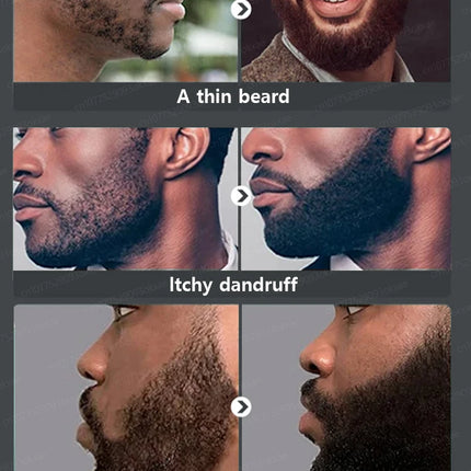 Beard growth essence. It helps your beard grow quickly, and is a must-have for mature men. It makes you look more manly and is e
