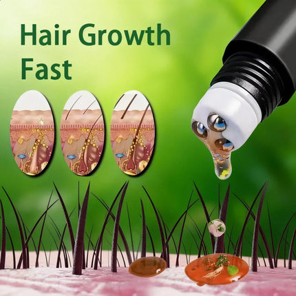 Biotin fast Hair Growth oil Products Care Scalp Massage Treatments Anti Hair Loss Effective Grow Thicker Hair serum for men