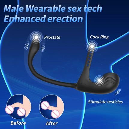 3 in 1 Anal Plug Vibrator Testicle Taint Stimulator Vibrating Cock Ring Remote Control Male Prostate Massager Sex Toy for Couple