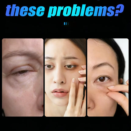 2026Suitable for both men and women,helping people who Around the eyes solve their problems