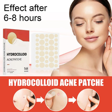 144pcs Invisible Removal Pimple Anti-Acne Hydrocolloid Patches Spots Marks Concealer Repair Sticker Waterproof Beauty-health