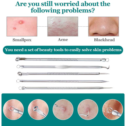Ultra-fine No.5 cell blackhead and acne tweezers for facial beauty a special needle tool for women to remove blackheads and acne