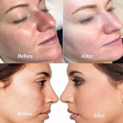 Stayve BB Cream Glow Beginner Starter Kit Whitening Liquid Foundation Acne Hyaluronic Acid Serum Facial Skin Care Beauty
