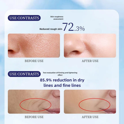 Rediscover Youthful Smoothness: Line-Free, Healthy Skin