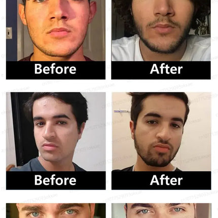 Beard growth essence. It helps your beard grow quickly, and is a must-have for mature men. It makes you look more manly and is e