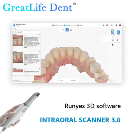 Runyes V3 Pro 3.0 Dental Digital Imaging Scanner Odontológico 3D Intraoral Scanner with Friendly Software & Ortho Simulation