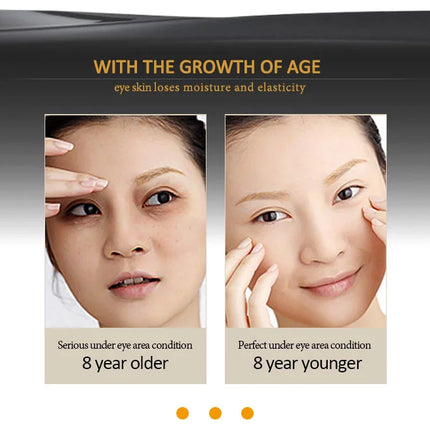 ARTISCARE Snail Face Cream + Peptide Eye Roller + Golden Eye Cream 3Pcs for Facial Moisturizing Serum Dark Circles Eye Care
