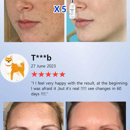 2025 Bestselling Facial Spot-Fading Cream, Effectively Removes Facial Dark Spots