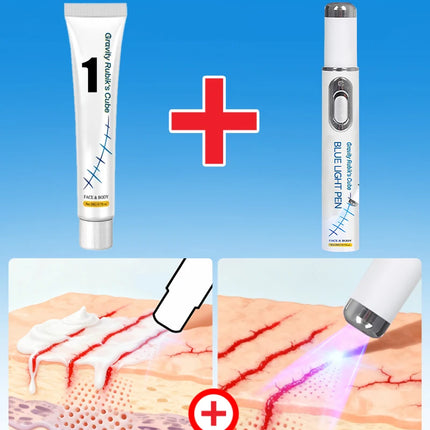 Striae Laser Device Eliminate Body Stretch Marks Products