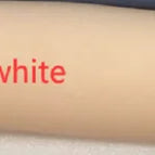 white skin