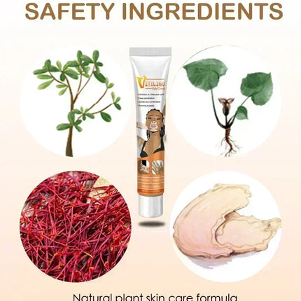 [New] Vitiligo Cream Vitiligo Remover Tinea Versicolor Body Lotion Helps Get Rid of Sweat Spot Vitiligo, Skin Vitiligo Clear