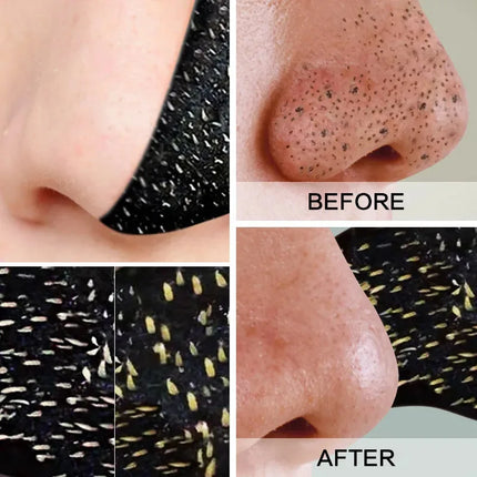 5/50/100pcs Removedor De Cravo Bamboo Charcoal Blackhead Remover Nose Mask Strips for Nose Cleansing Nose Sticker Deep Clean