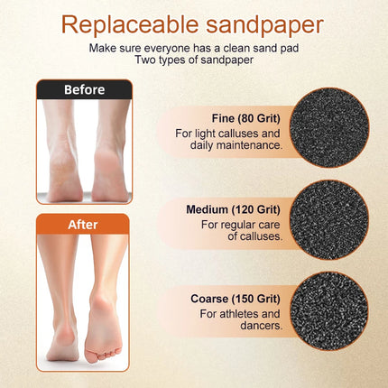 Gold 2 in 1 electric foot callus remover with 30pcs Sandpaper Discs, Aluminum Callus Remover for Feet Electric Care Tool