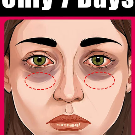 Eye cream to eliminate dark circles and eye bags, nourishing the skin around the eyes to make you look younger.