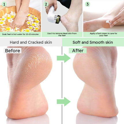 Rechargeable Foot Callus Remover Electric Pedicure Tool with Vacuum 6 Replaceable Heads USB Charging
