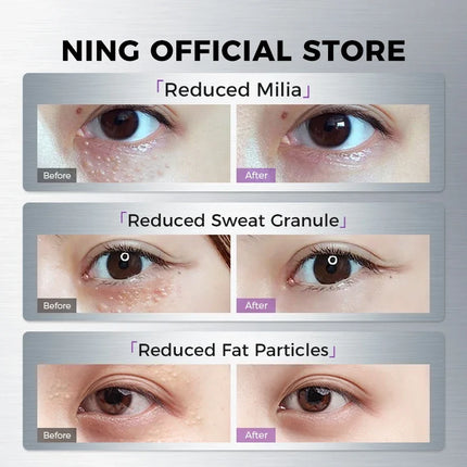 Eye Serum for Dark Circles, Puffiness & Fine Lines – Firming & Hydrating Eye Essence with Retinol & Caffeine
