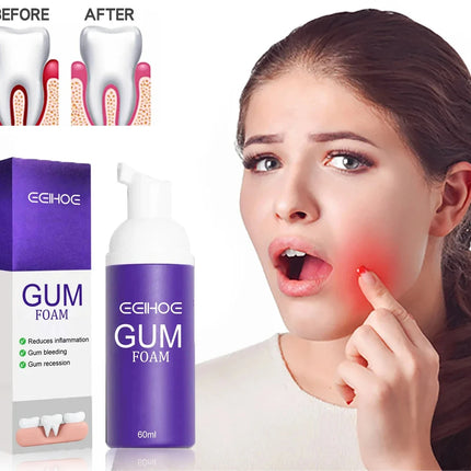 Rapid Repair Gums Gel Effectively Relieve Tooth Allergy Dental Caries Tooth Cleaning Toothpaste Relieve Tooth Damage Serum 665*