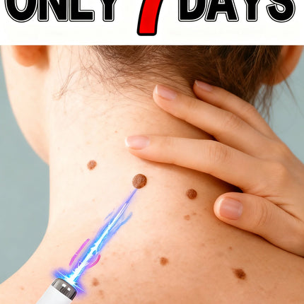 Best-Selling Blue Light Pen: Effective for Body Wart Removal & Wart Care